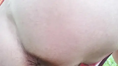 MILF with ostomy bag in woods, close-up ass shots